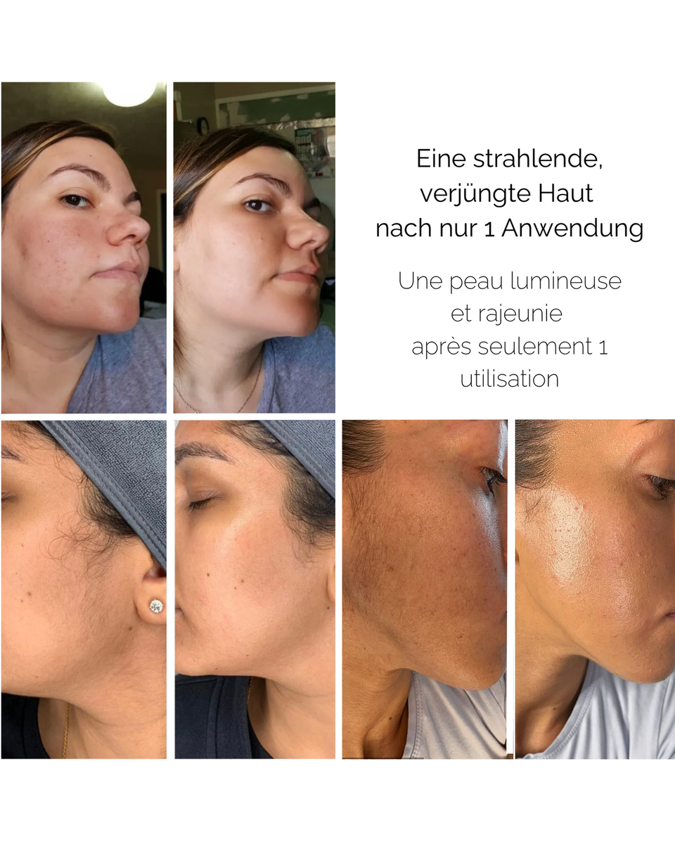 Dermaplaning-Routine - Strahlender Teint